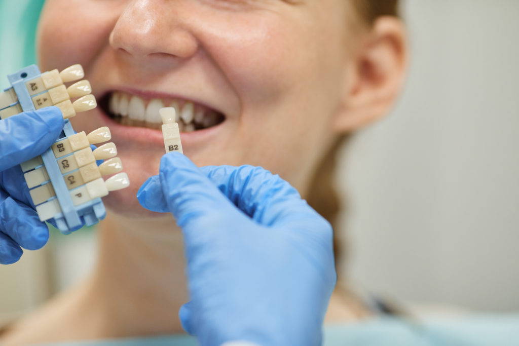 dental implants for patient FG2TABM