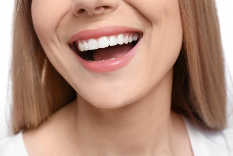 Featured image for “Enhance Your Smile with Professional Teeth Whitening in Hamilton”