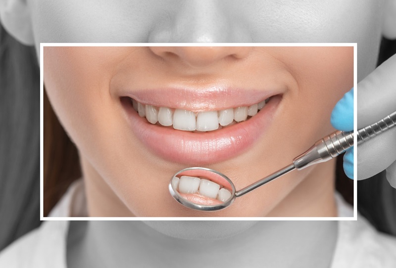 Cosmetic Dentistry in Hamilton