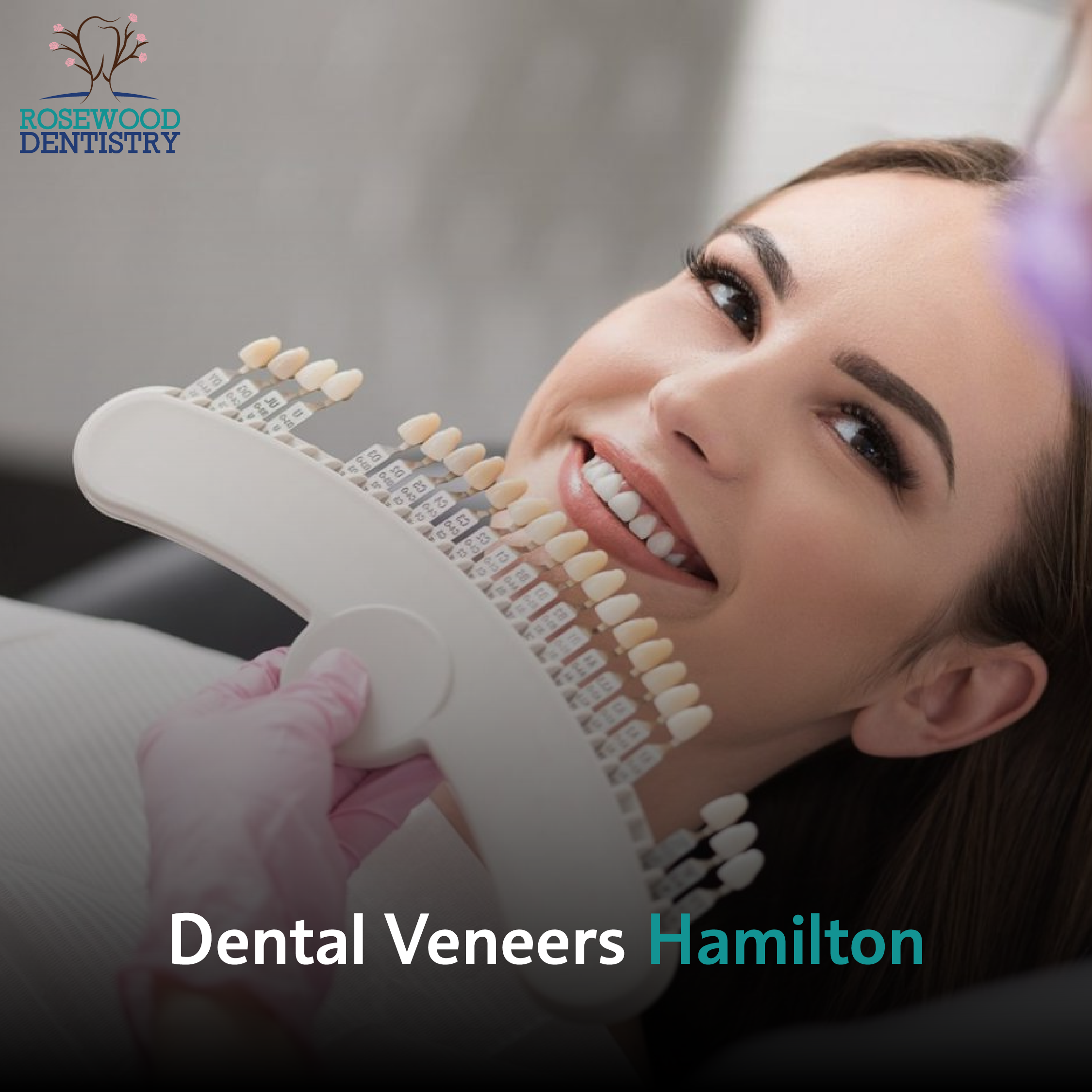 Featured image for “Transform Your Smile with Dental Veneers in Hamilton”