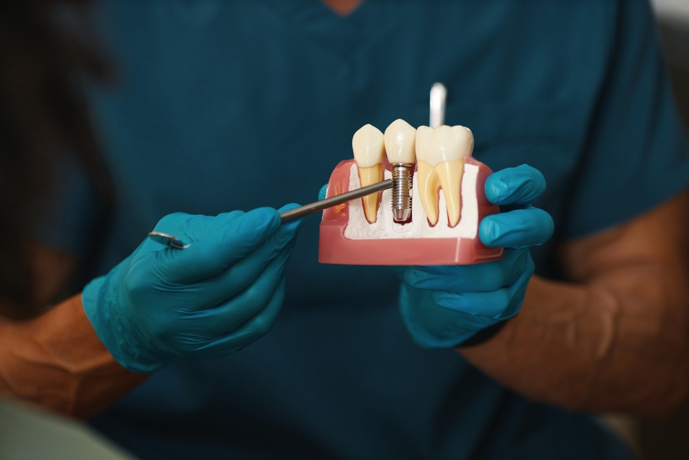Expert Dentist in Hamilton