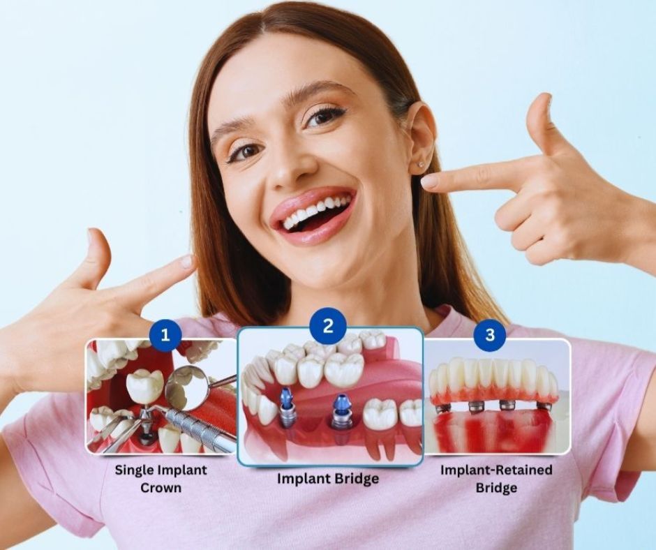 Dental implants in Hamilton ON