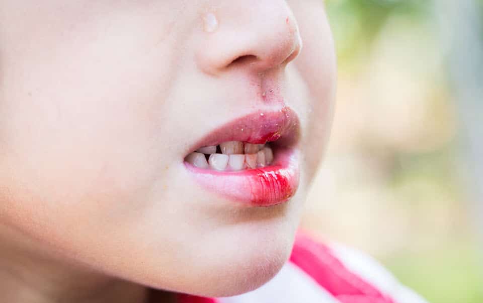 Emergency Dental Services in Hamilton ON