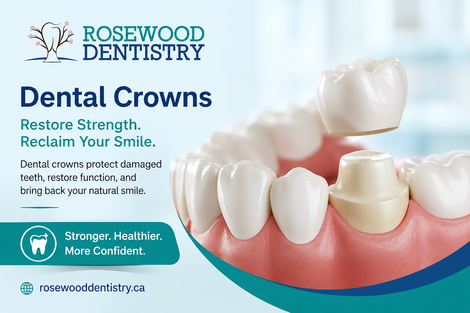 Featured image for “What Are Dental Crowns? Benefits, Procedure, and Aftercare”